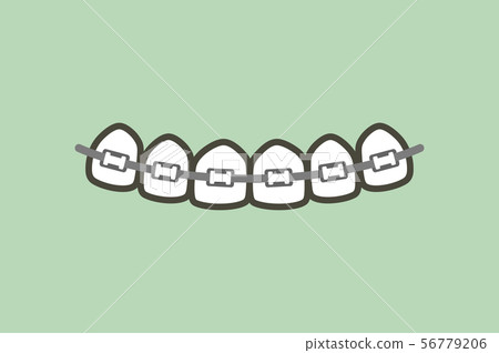 orthodontics teeth or dental braces 56779206