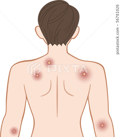 Title Festering upper body behind male 56781026