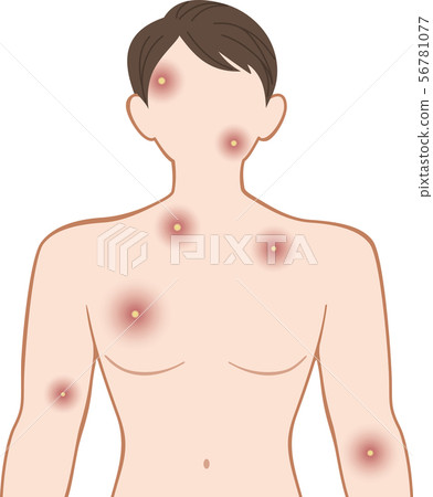 潰爛上半身，前男性 56781077