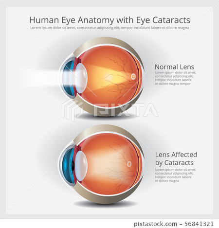Human Eye Anatomy Vector Illustration - Stock Illustration [56841321 ...