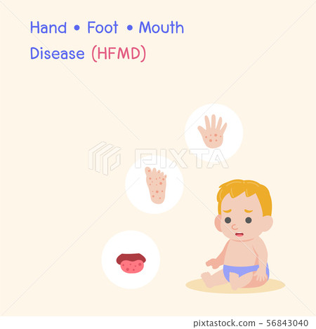 Hand, Foot, and Mouth Disease (HFMD) Medical 56843040