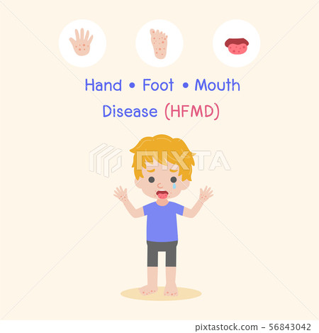 Hand, Foot, and Mouth Disease (HFMD) Medical 56843042