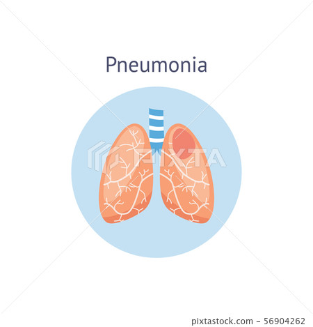Pneumonia disease diagram a healthy and damaged lungs vector illustration isolated. Pneumonia disease diagram a healthy and damaged lungs vector illustration isolated. 56904262