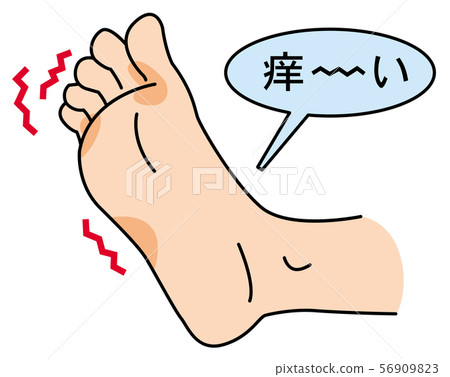 發癢的水運動員的腳 56909823