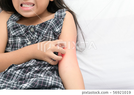 girl scratch the itch with hand , girl scratch the itch with hand , 56921019
