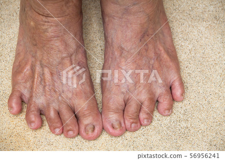senior woman's feet are standing on Polished stone texture background, Close up, Body concept senior woman's feet are standing on Polished stone texture background, Close up, Body concept 56956241