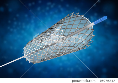 Stent for balloon angioplasty 56976842