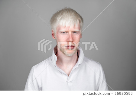 portrait of an albino man in studio dressed 56980593
