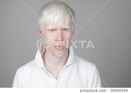 portrait of an albino man in studio dressed portrait of an albino man in studio dressed 56980594