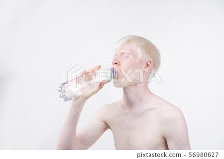 portrait of an albino man in studio dressed 56980627