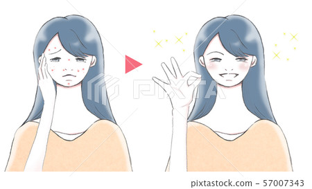 痤瘡皮膚和痤瘡癒合的皮膚微笑的女人 57007343