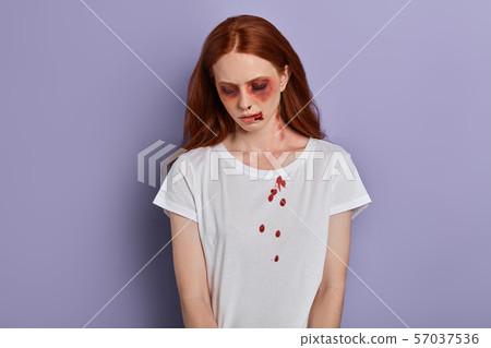 injured woman crying, looking down, feels uncomfortable injured woman crying, looking down, feels uncomfortable 57037536