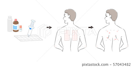 貼片測試刺痛測試檢查程序男 57043482