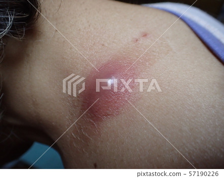 Funryu（粉末） 57190226