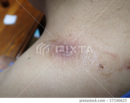 Funryu (powder) Funryu (powder) 57190625