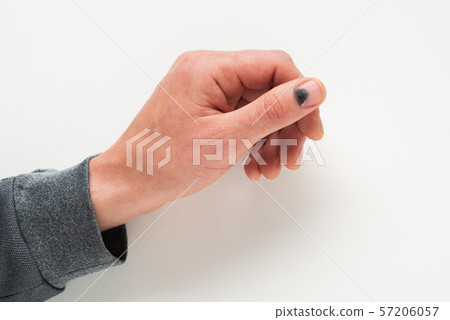 Blackened nail after injury 57206057