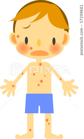Boy rash - Stock Illustration [57209681] - PIXTA