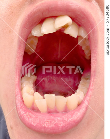 撥浪鼓牙列 57234690