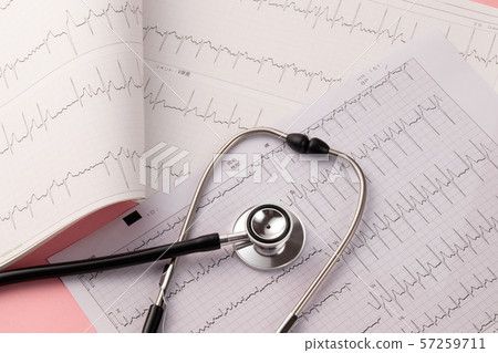 心電圖醫學圖像 57259711