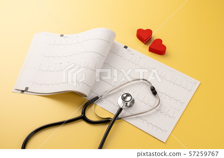 心電圖醫學圖像 心電圖醫學圖像 57259767