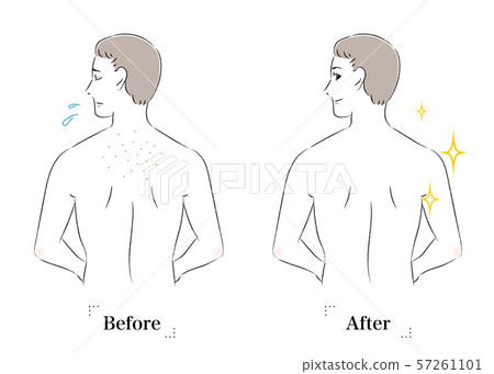 背部皮膚在男性之前擔心毛孔黑皮膚 背部皮膚在男性之前擔心毛孔黑皮膚 57261101