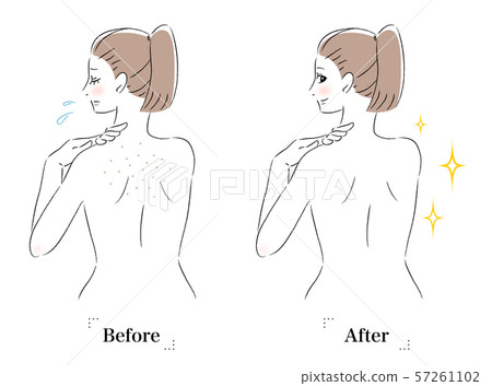 背部皮膚擔心毛孔黑色皮膚前後婦女 背部皮膚擔心毛孔黑色皮膚前後婦女 57261102