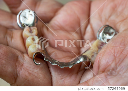 Senior woman's hand holding Artificial teeth, Acrylic and Vitallium metal, Stomatology & False Dentures set concept, Close up & Macro shot, Selective focus 57265969