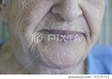 Closeup face of a senior person 57275721