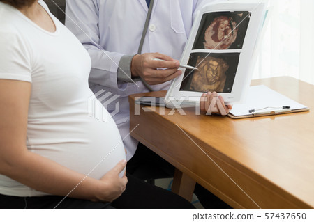 Doctor holding 4D ultrasound image result and talking to the pregnant woman.  57437650