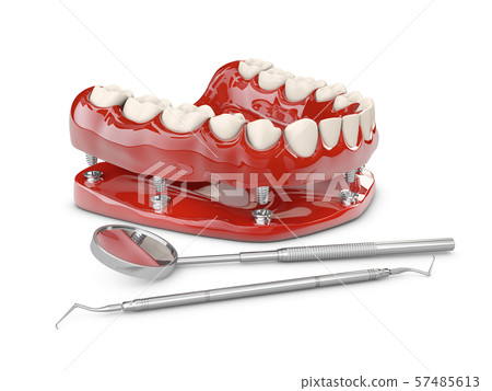 Human teeth and Dental implant. 3d illustration 57485613