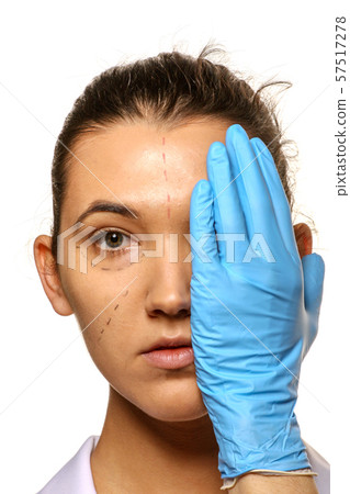 Survey before plastic surgery. Survey before plastic surgery. 57517278