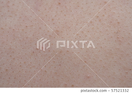 Macro shooting of the young pink human's epidermis texture 57521332