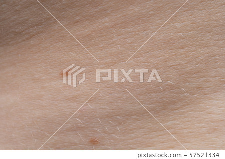 Macro photo of the young pink human's skin with nevi 57521334