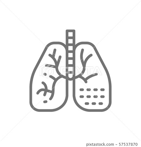 Lung disease line icon. Isolated on white background 57537870