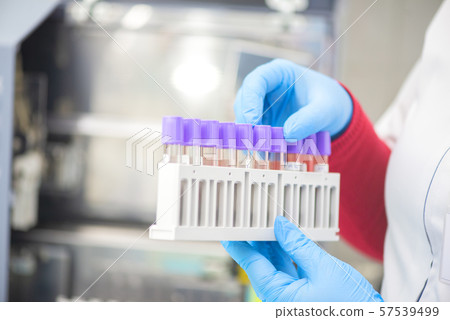 doctor hand taking a blood sample tube from a rack 57539499