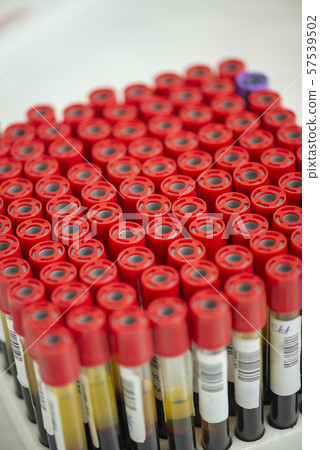 Tubes of blood sample for testing Tubes of blood sample for testing 57539502
