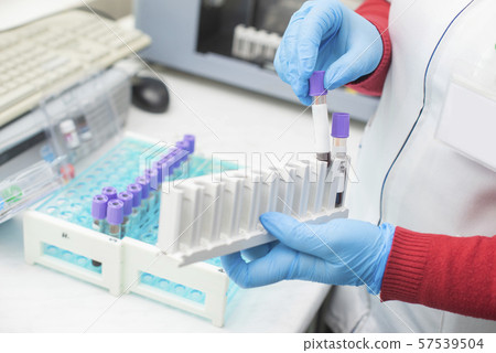 doctor hand taking a blood sample tube from a rack doctor hand taking a blood sample tube from a rack 57539504