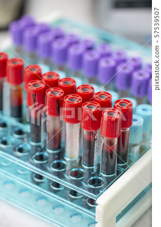 Tubes of blood sample for testing 57539507
