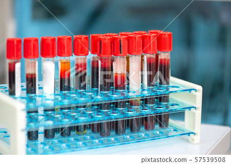 Tubes of blood sample for testing Tubes of blood sample for testing 57539508