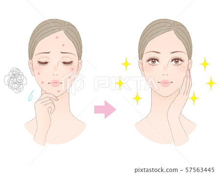 Beauty image acne 57563445