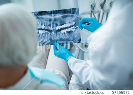 Dentist is discussing female patient x-ray in clinic 57566971