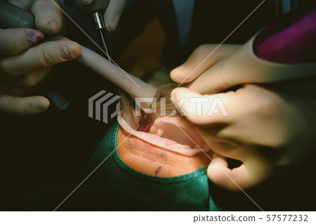 Dental care check up, Dentist examining. 57577232