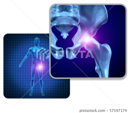 Human Hip Joint Pain Human Hip Joint Pain 57597174
