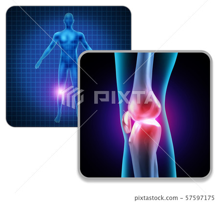 Human Knee Joint Pain Human Knee Joint Pain 57597175