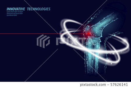 Human knee joint 3d model vector illustration. Low poly design future technology cure pain treatment Human knee joint 3d model vector illustration. Low poly design future technology cure pain treatment 57626141