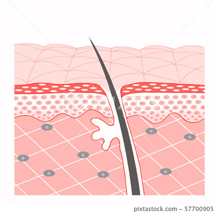 Skin cross section 57700905