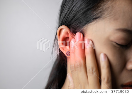 Young woman is suffering of earache. 57719080