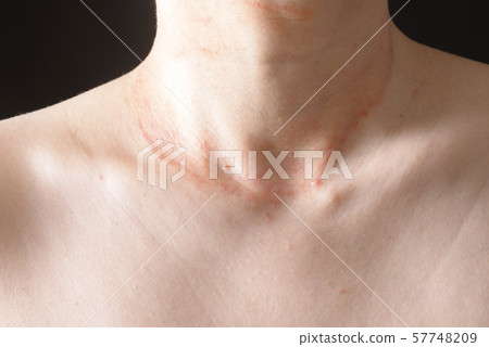 Women with skin disease Women with skin disease 57748209