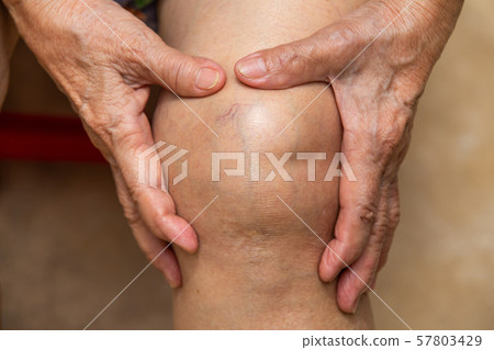 Senior woman suffering from knee pain sitting on chair, Massaging by her hand, Close up, Body concept Senior woman suffering from knee pain sitting on chair, Massaging by her hand, Close up, Body concept 57803429