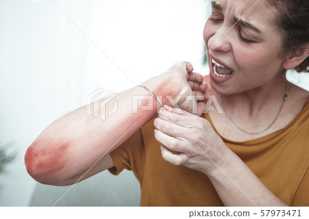 Woman feeling awful mentioning rash and reddening on her arm Woman feeling awful mentioning rash and reddening on her arm 57973471